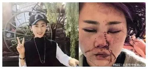 唐山事件后续吃瓜视频,吃瓜视频揭秘真相与争议